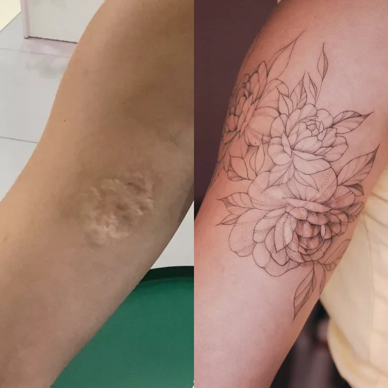 cover up tattoo